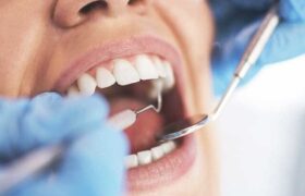 ارائه خدمات دندانپزشکی با تعرفه دولتی در تعطیلات نوروزی