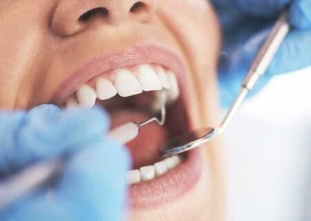 ارائه خدمات دندانپزشکی با تعرفه دولتی در تعطیلات نوروزی