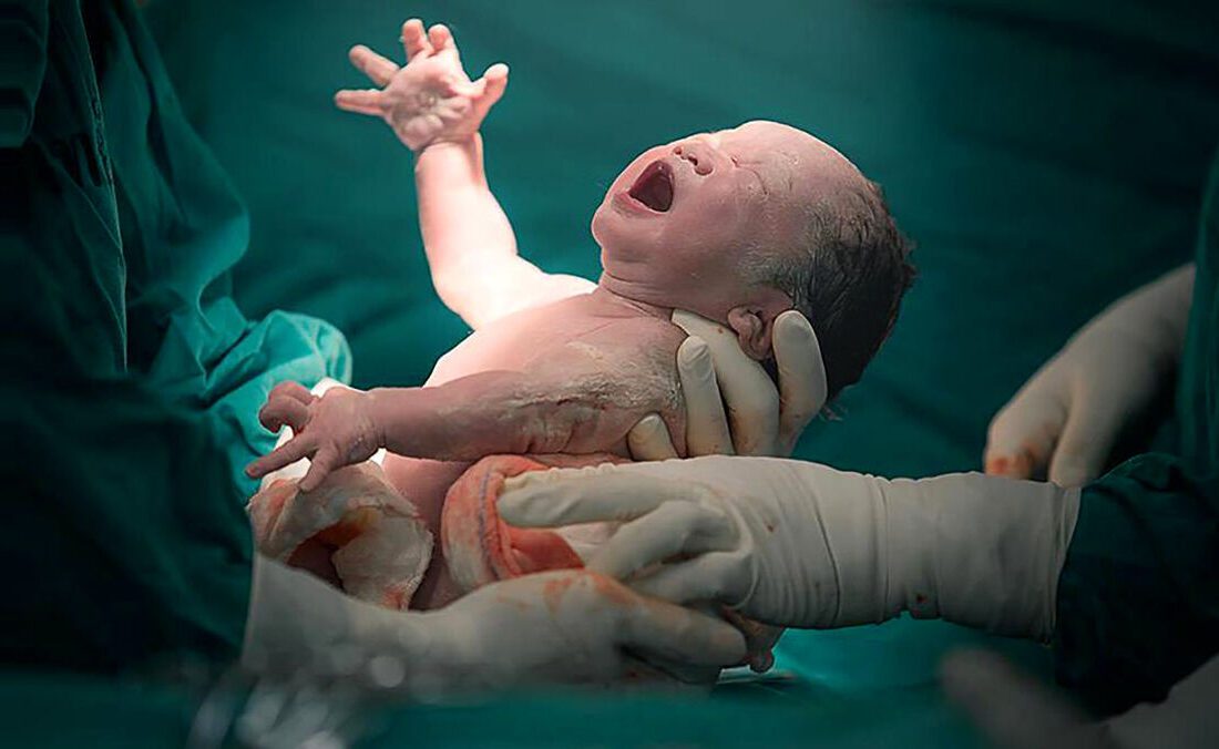 نجات معجزه‌آسای مادر باردار پس از ایست قلبی در اتاق عمل زایشگاه میناب