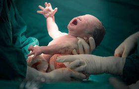 نجات معجزه‌آسای مادر باردار پس از ایست قلبی در اتاق عمل زایشگاه میناب