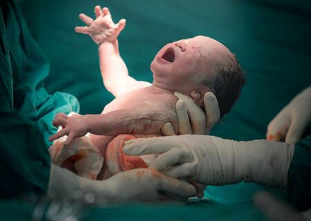 نجات معجزه‌آسای مادر باردار پس از ایست قلبی در اتاق عمل زایشگاه میناب