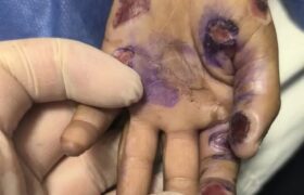 مرگ کودک ۴ ساله رودانی با احتمال کودک آزاری