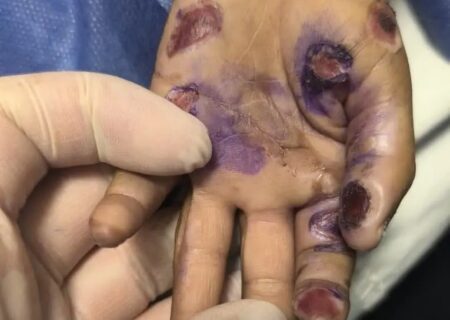 مرگ کودک ۴ ساله رودانی با احتمال کودک آزاری