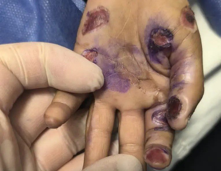 مرگ کودک ۴ ساله رودانی با احتمال کودک آزاری